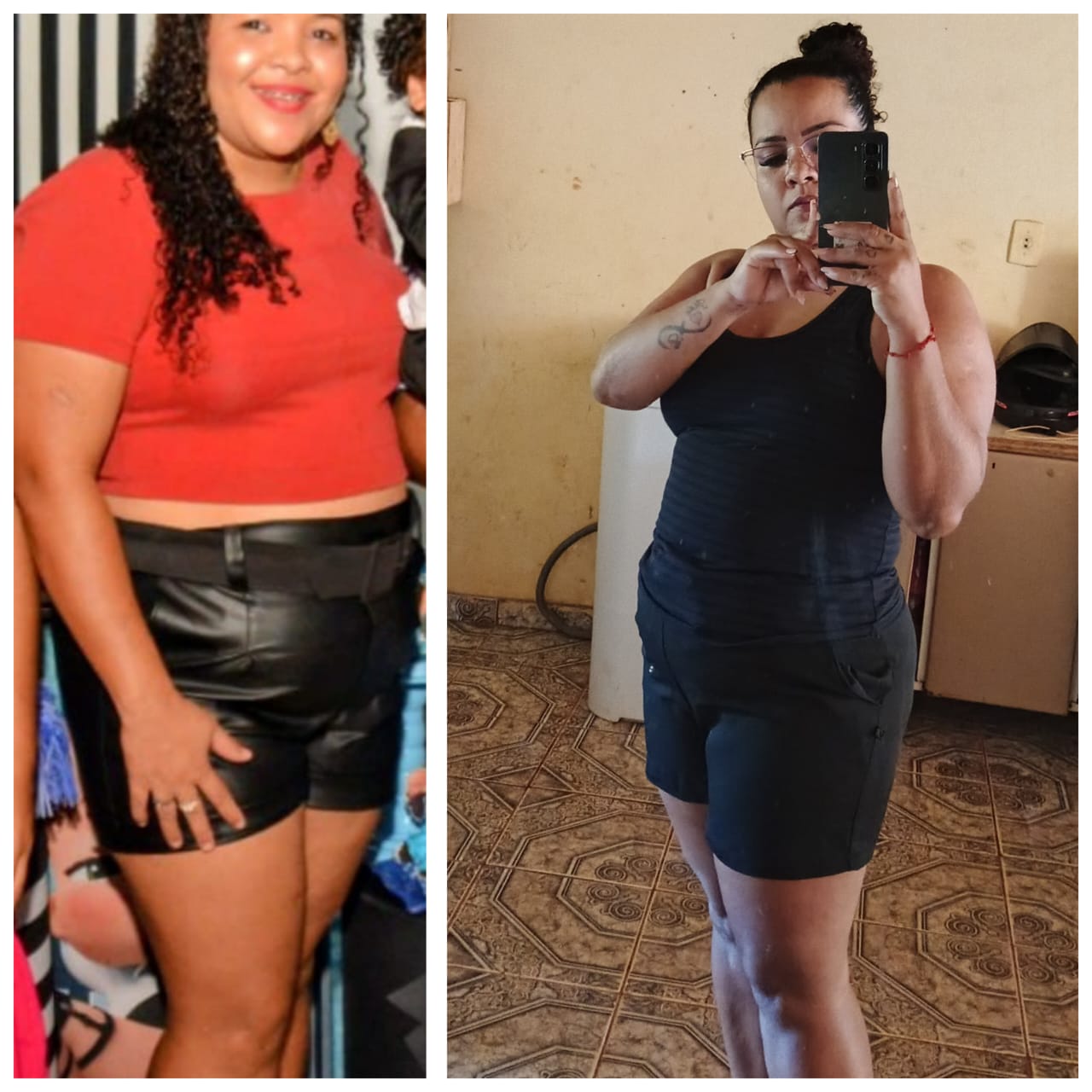 Antes e depois de cliente após uso do LipoMed